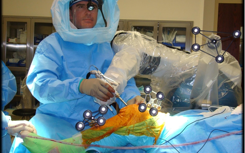 Lần đầu tiên tại Việt Nam dùng robot phẫu thuật khớp gối, thần kinh