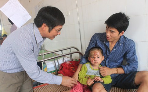 Điều trị miễn phí cho một bệnh nhi người Lào bị bỏng nặng
