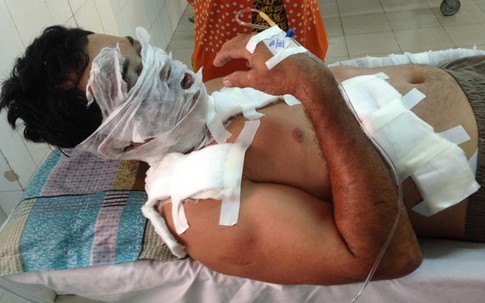 Lật lại hồ sơ vụ chủ hãng nước đá ở miền Tây bị tạt axít