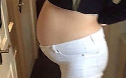 Tưởng mang bầu 8 tháng, bà mẹ giật mình phát hiện thứ kinh dị này trong bụng