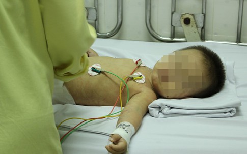 Bé trai 14 tháng tuổi suýt mất mạng vì uống nhầm dầu