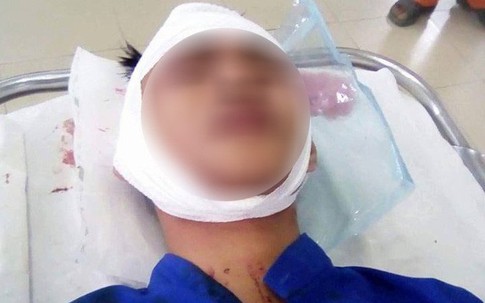 Nhóm thanh niên thấy người là chém khiến người dân hoang mang