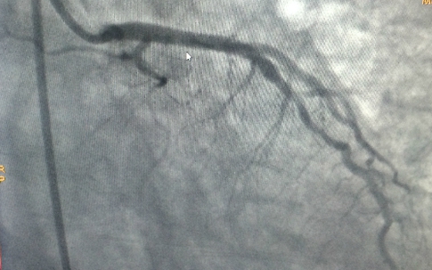 Nỗ lực hồi sinh người đàn ông nhiều lần chết đi sống lại