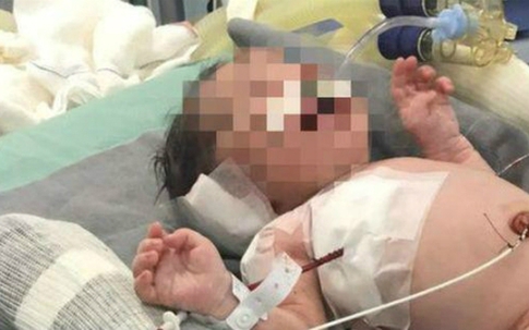 Em bé sống sót kỳ diệu sau khi trúng đạn từ trong bụng mẹ