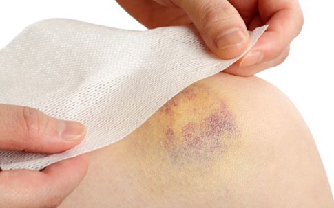 Dấu hiệu cảnh báo ung thư máu bạn thờ ơ bỏ qua mà không hay biết