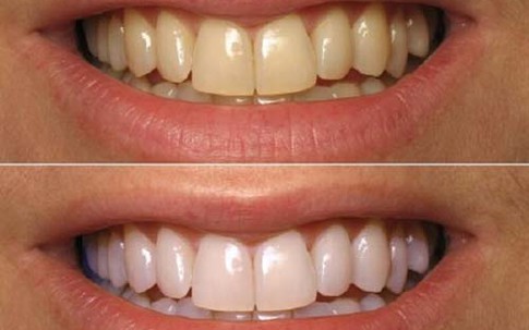 Lọ nước rẻ bèo này có tác dụng làm đẹp tới không tưởng!