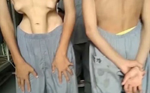 Hai thiếu niên Thiếu Lâm Tự làm nội tạng 'nhảy múa'