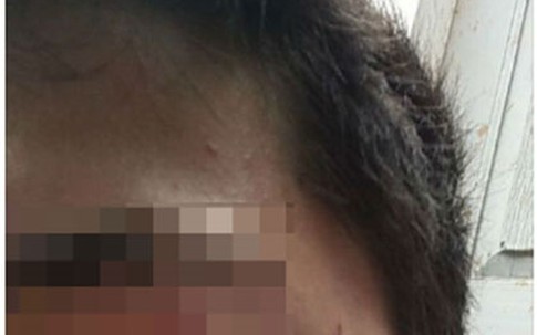 Phản đòn khi bị chồng đánh, chiêu may rủi của các bà vợ