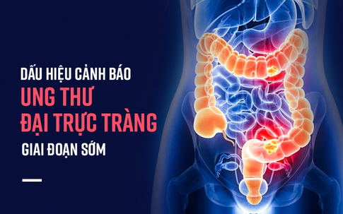 Nếu sáng ngủ dậy đau bụng hoặc có triệu chứng sau, bạn nên khẩn trương đi khám ung thư