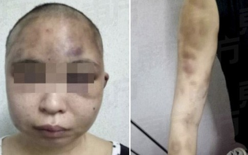 Chồng đánh đập, cạo trọc đầu vợ vì nghi có bồ