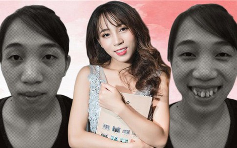 Những ca thẩm mỹ làm thay đổi cả số phận gây bão năm 2017