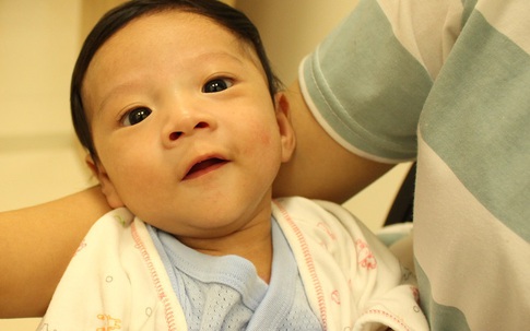 Cứu sống bệnh nhi sơ sinh mắc nhiều dị tật tim bẩm sinh nặng