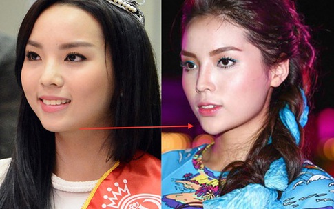 Suốt từ ngày đăng quang đến bây giờ, Kỳ Duyên thay đổi thế nào với nhiều nghi án thẩm mỹ?