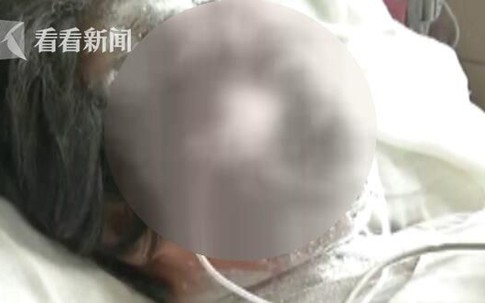 Phẫn nộ lý do con trai tạt axit khiến mẹ bị hủy hoại dung nhan và mù cả 2 mắt