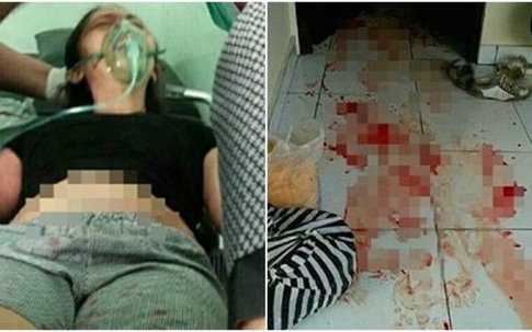 Sốc: Chồng chặt cụt chân vợ ngay trước mặt con vì nghi ngoại tình