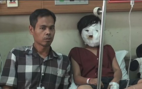 Kinh hoàng: Bà kế bị nghi ngờ ấn mặt cháu gái vào chảo dầu nóng vì không chịu làm việc nhà