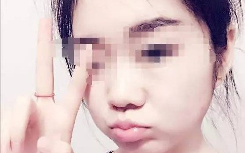 Nhà giàu, du học Mỹ về nhưng nam thanh niên theo đuổi cô gái 8 năm không được liền đẩy cô ngã từ tầng 19