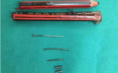 Mẹ bất ngờ phát bệnh tâm thần đâm bút chì vào cổ con gái 8 tuổi