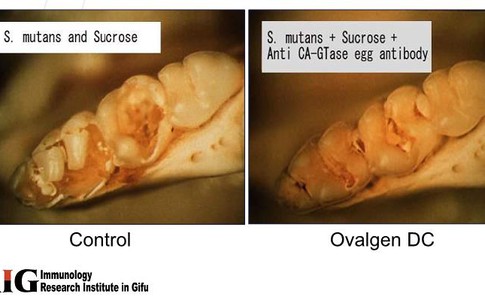 Nhật Bản phòng trị bệnh răng lợi bằng kháng thể Igy