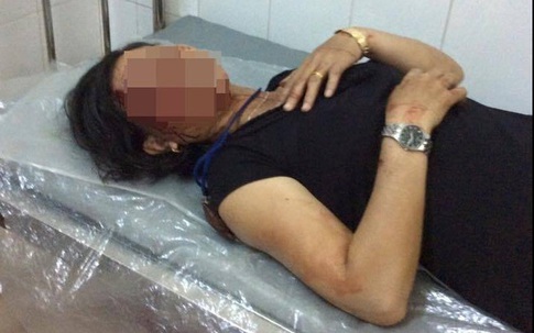 Chồng khóa trái cửa đánh vợ tàn nhẫn, máu chảy đầm đìa