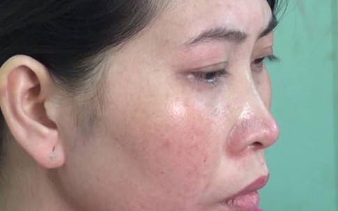 Vụ giết chồng phi tang xác: Người vợ không khóc nhưng nhiều lần ngất xỉu