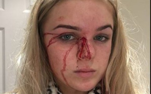 Cô gái 19 tuổi cố gắng thoát thân sau khi bị bạn trai lột sạch quần áo và đánh đập tàn nhẫn