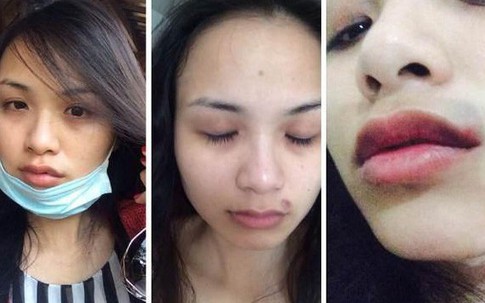 Xót xa cảnh những mỹ nhân Việt bị chồng vũ phu đánh đập, hành hạ tàn nhẫn