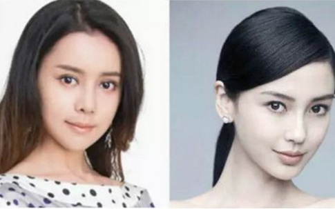 Cô gái Trung Quốc chi 100 triệu Nhân dân tệ để phẫu thuật giống diễn viên nổi tiếng