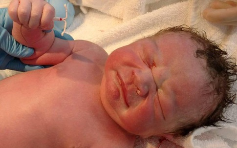 Bức ảnh đang gây "bão" mạng: Em bé sinh ra tay vẫn cầm... vòng tránh thai của mẹ
