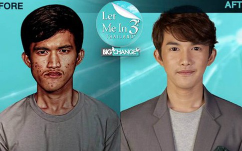 Con trai đẹp như tài tử sau thẩm mỹ khiến mẹ không thể nhận ra