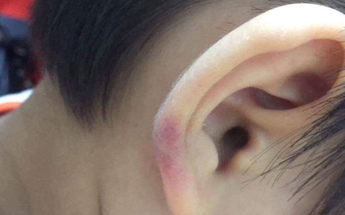 Cô giáo mầm non ở Hà Nội bạo hành con chồng: Phút kìm nén uất nghẹn của mẹ ruột khi quay clip bằng chứng