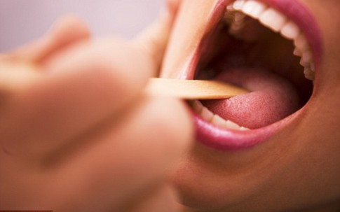 Không chỉ "quan hệ" đường miệng, thói quen lười biếng này cũng có thể dẫn đến ung thư vòm họng