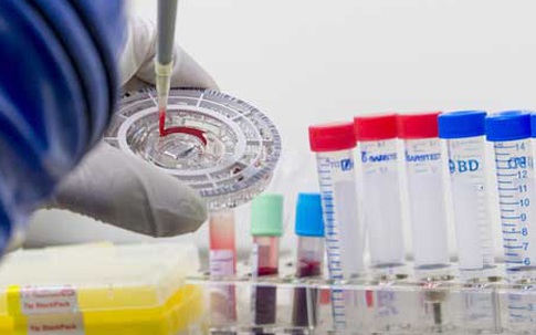 Thời gian điều trị và tuổi thọ của bệnh nhân viêm gan là bao lâu?