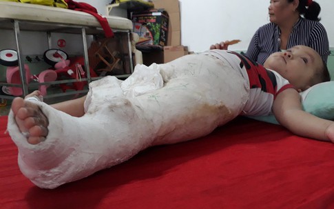 Bình Dương: Cần làm rõ vụ cháu bé 15 tháng tuổi bị gãy chân tại nơi giữ trẻ