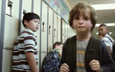 Bạn sẽ xử lý thế nào nếu con bạn nhìn chằm chằm vào một người có vẻ ngoài “khác biệt”?