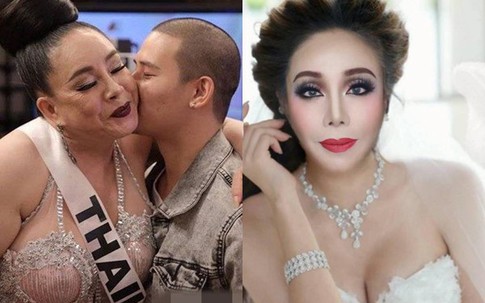 Sự thật về gương mặt sưng vù của nữ đại gia U60 kén chồng trẻ có thể quan hệ 28 lần/ngày