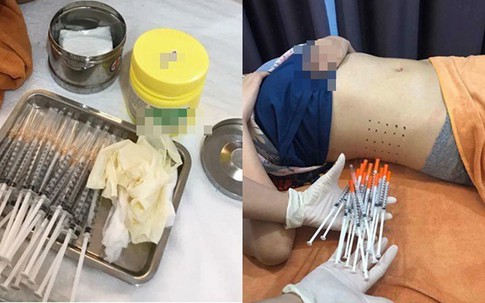 Sự thật đằng sau những ống tiêm tinh chất giảm cân đắt đỏ