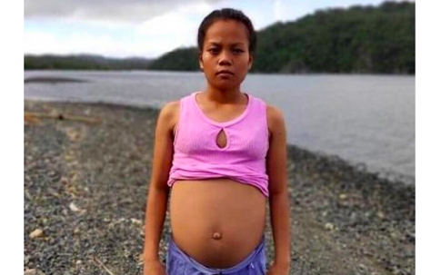 Thiếu nữ có bụng to bất thường khiến dân làng nghi mang thai với cá và sự thật 'ngã ngửa'