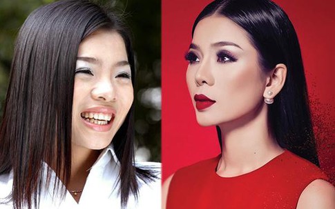 Tháo sụn mũi đã là gì, đây mới là bước "lên đời" nhan sắc sáng suốt nhất của Lệ Quyên