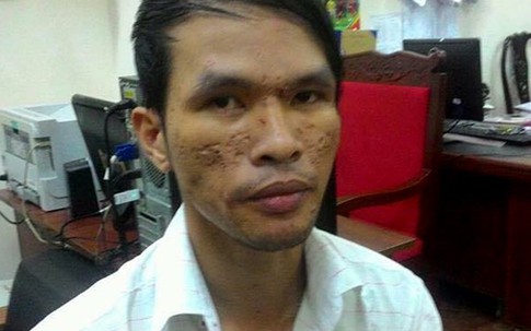 Kẻ hành hạ bé trai Campuchia bằng roi điện được tại ngoại