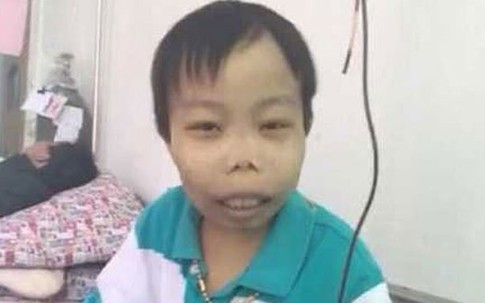 'Thiếu gia xấu xí' từng khiến dân mạng náo loạn giờ ra sao?