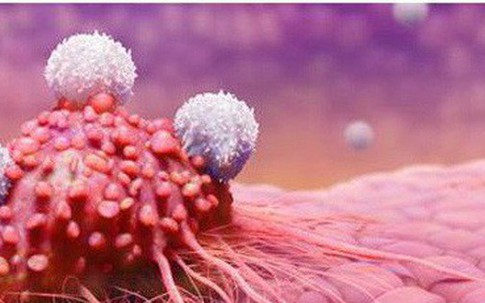 Bác sĩ Việt tại Nhật chỉ ra nghịch lý chống ung thư ở Việt Nam và những ví dụ đáng buồn