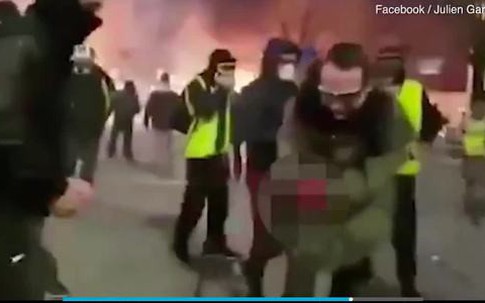 Người biểu tình Pháp bị nổ nát bàn tay vì cầm lựu đạn cay