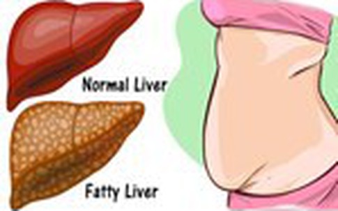 Chuyên gia dinh dưỡng BV Bạch Mai "bật mí" 2 cách thải độc gan, thận cực kỳ đơn giản
