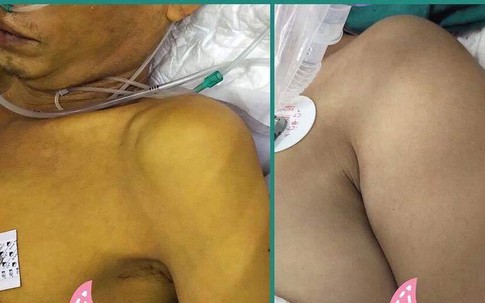 BS Bệnh viện Việt Đức cảnh báo: Đang uống thuốc Tây, bạn uống thêm thứ này thành... tự sát