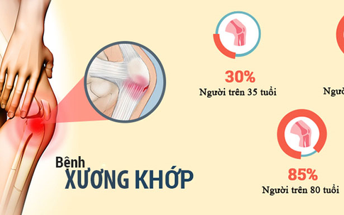 Những sai lầm cần tránh khi sơ cứu người già bị ngã