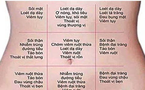 Chuyên gia đầu ngành tiêu hóa chỉ cách đoán bệnh qua vị trí đau vùng bụng ai cũng nên biết