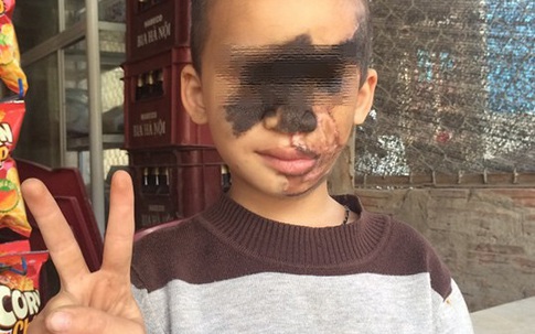 Niềm vui đầu năm mới của cậu bé có khuôn mặt 2 màu đen trắng