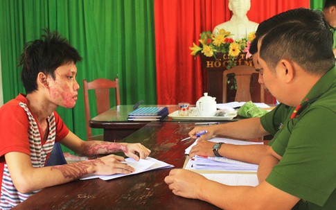 Bắt tạm giam kẻ tạt axít vào người tình rồi tự tử