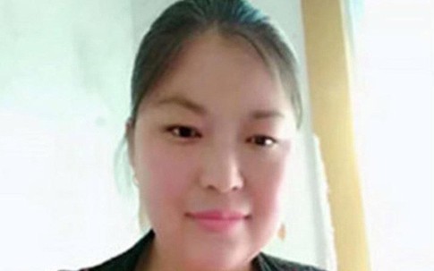 Phẫn nộ người phụ nữ bị biến dạng hoàn toàn sau khi bị chồng cũ trả thù tàn độc